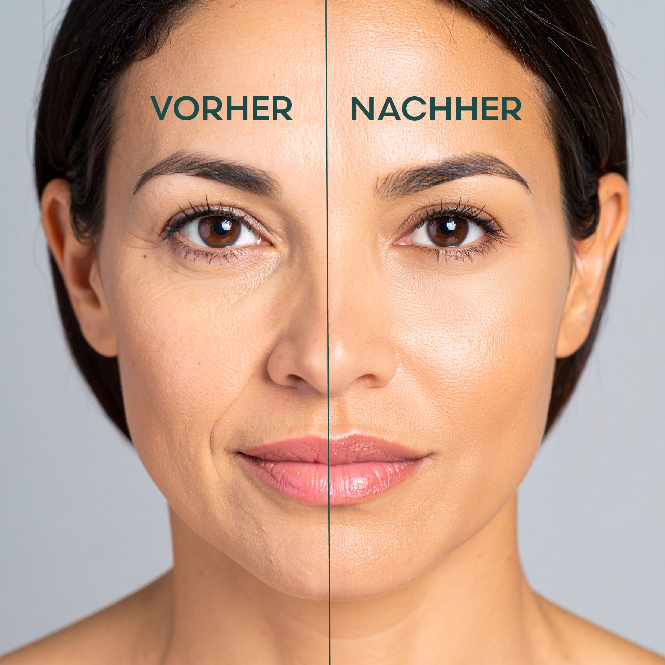 LIV NATURAL Kollagen Nahrungsergänzungsmittel – unterstützt Hautelastizität und natürliche Schönheit bei Frauen